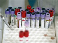 2011: 10 HIV Stories to Watch, Part 2