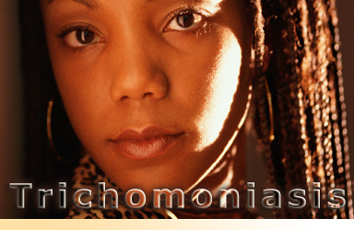 Trichomoniasis