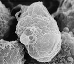 Electron microscope image of HIV, seen as small spheres on the surface of white blood cells.