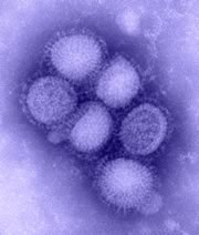 The image is of the newly identified H1N1 (swine) flu virus taken in the CDC Influenza Laboratory.