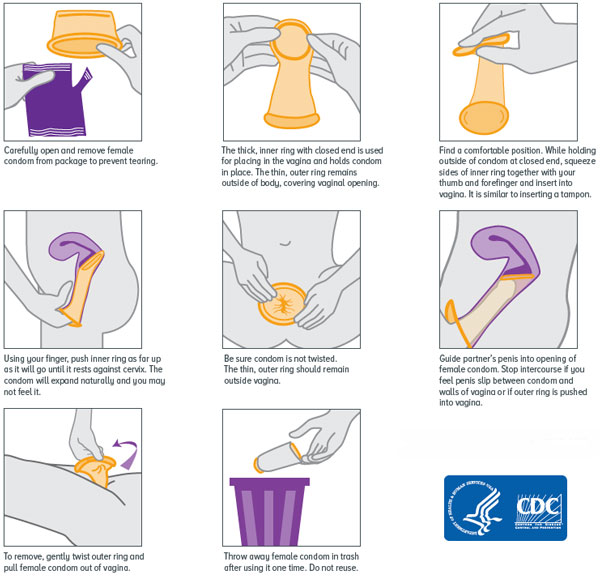 The Right Way To Use A Female Condom