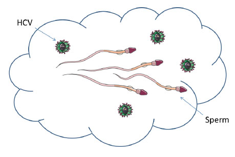 High HCV Levels in Semen