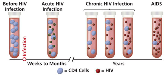 HIV Progression