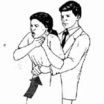 Maniobra de Heimlich