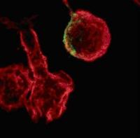 This is the actin cytoskeleton of human T-lymphocytes (red) in the presence of the stimulus CCL-19. An HIV-1 infection (HIV-1 protein CA in green) leads to the loss of actin reorganization and therefore of cell motility.
