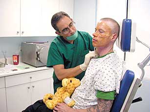 Facing Up to It: Bio-Alcamid as a Facial Filler to Treat Lipoathrophy