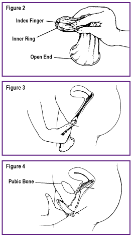 Once you have inserted the closed end of the pouch, use your index finger to 