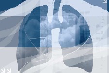 Tuberculosis (TB)