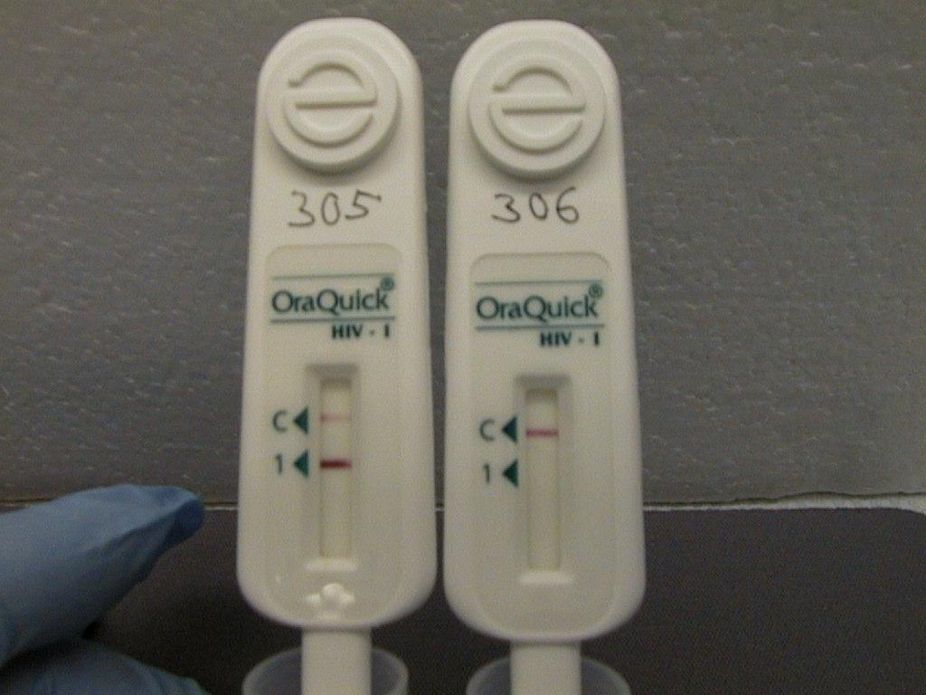 Negative Rapid Hiv Test