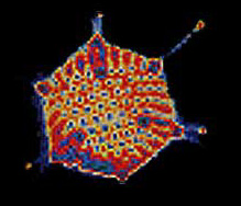 Hepatitis A