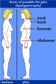 Steroids and after effects