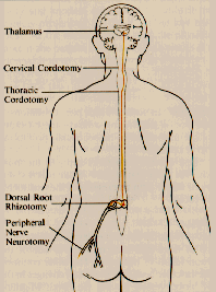 Spinal Cord Diagram
