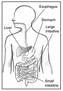 Hepatitis C is a liver disease.