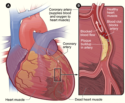 The heart and coronary artery