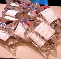 A Week's Worth of Foscarnet