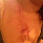 cut skin