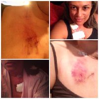 Mediport drama! Top the first, bottom the second.